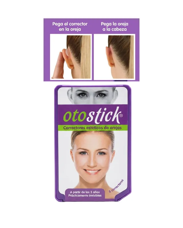 CORRECTORES ESTETICOS DE OREJA OTOSTICK (2006)